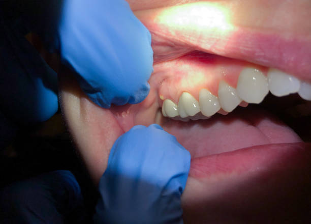 Best Emergency Cosmetic Dentistry in Bass Lake, IN