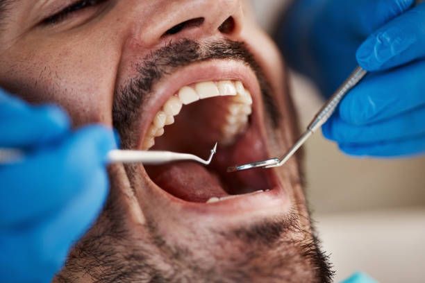 Best Broken or Cracked Tooth Emergency Dentist in Bass Lake, IN